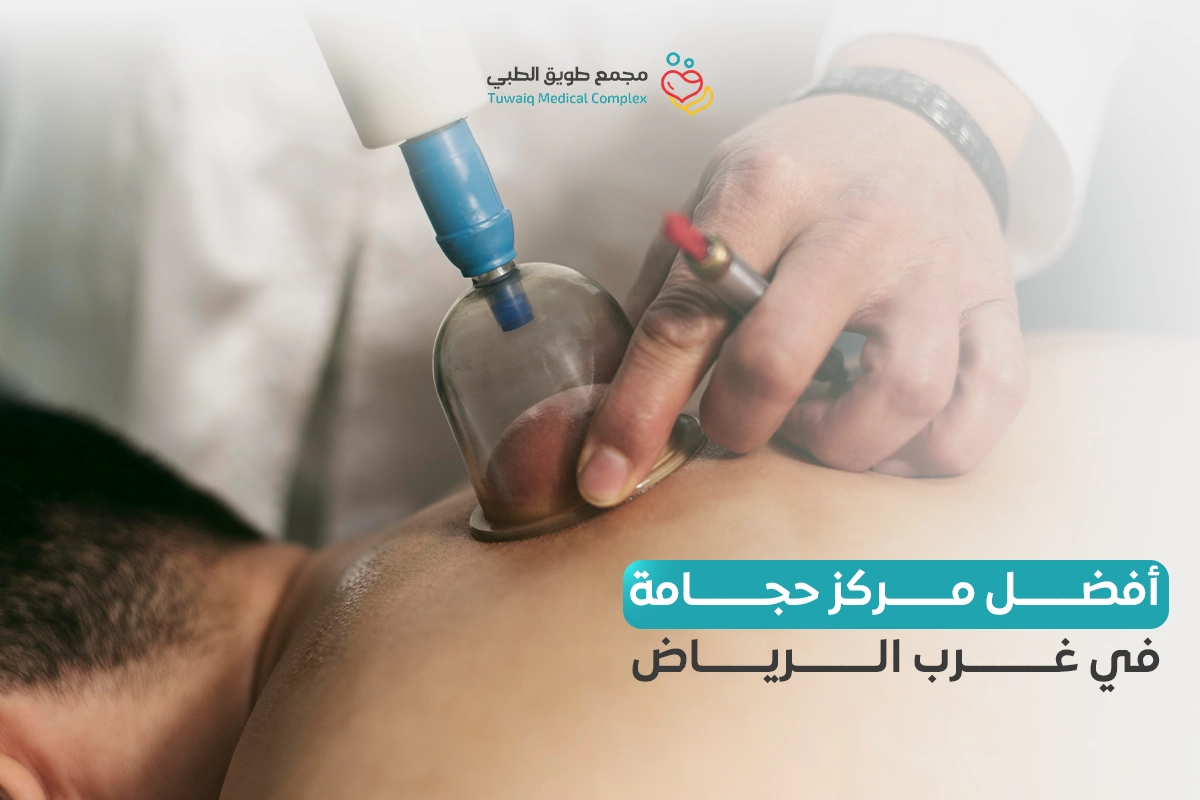 Best Hijama Center in West Riyadh